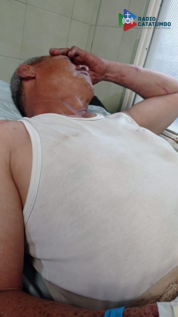 Herido por robarlo
