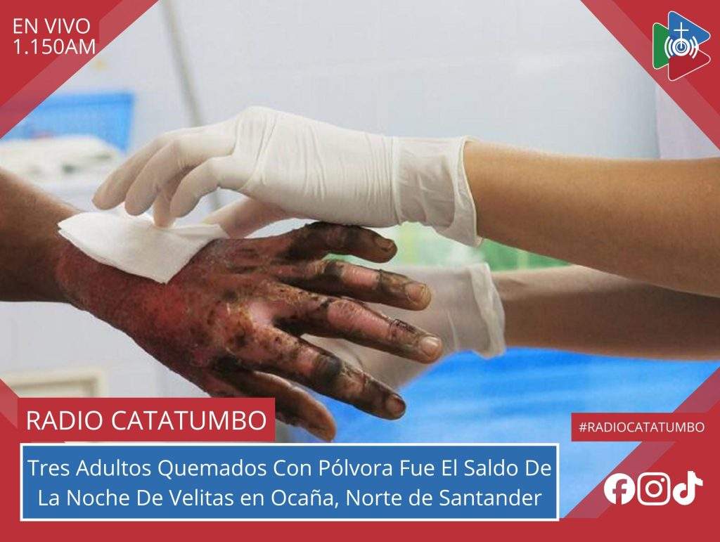 Imagen de referencia – Tres ciudadanos de 18, 33 y 37 años de edad resultaron heridos con quemaduras tras la manipulación de polvora en Ocaña, Norte de Santander / Foto: Alcaldía de Dosquebradas